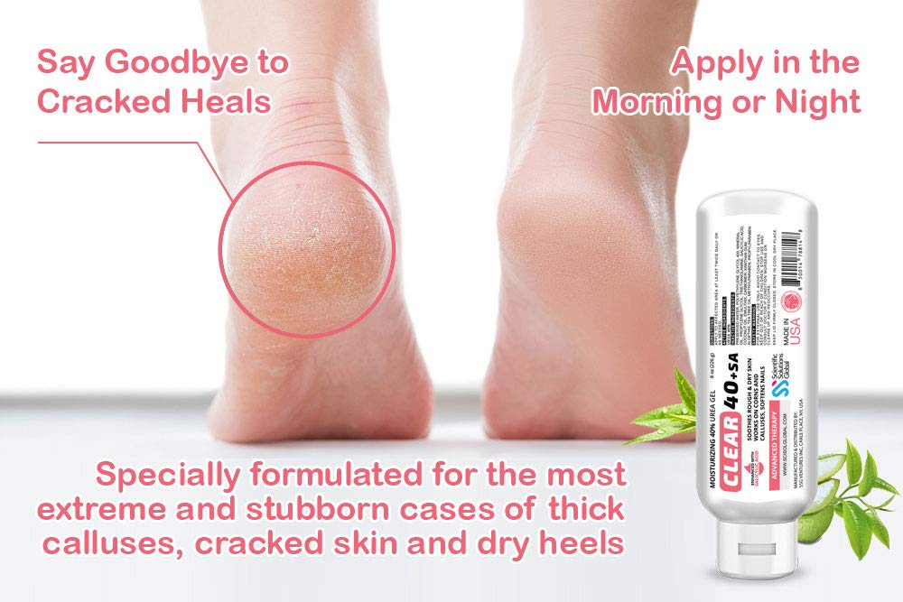 CLEAR 40 +SA, 40% Urea Gel + 2% Salicylic Acid, 8 oz