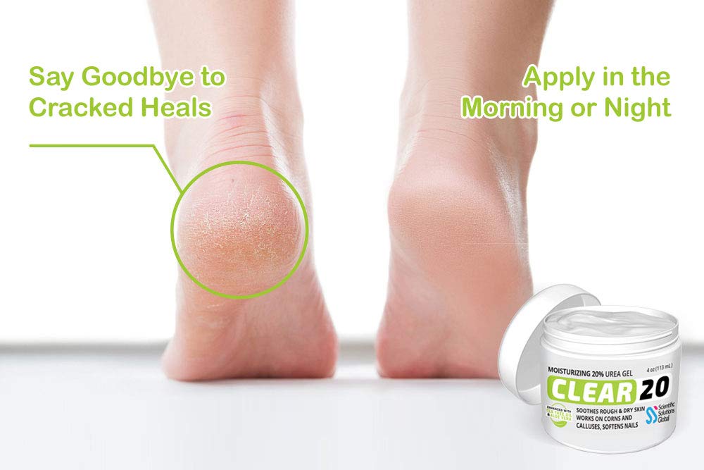 CLEAR 20, 20% Urea Gel, 4 oz