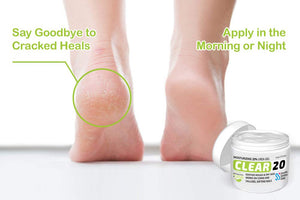 CLEAR 20, 20% Urea Gel, 4 oz